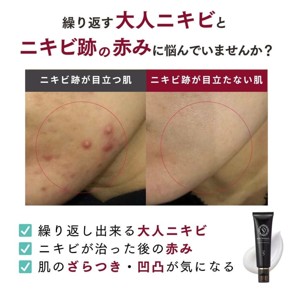 ベルホワイティアン5＋ - ドクターRe9公式オンラインショップドクター