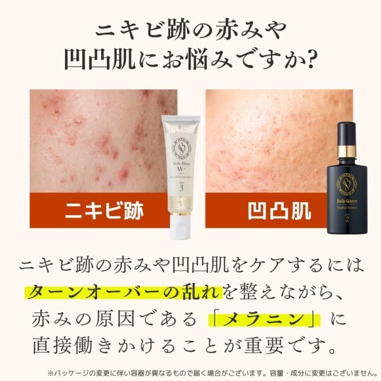ベルクイーンセット Amazon | ドクターRe9 [薬用] ニキビ跡 専用 スキンケア4点
